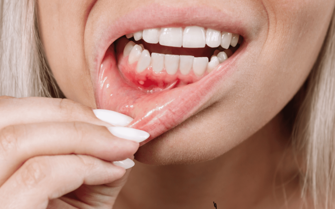 How Poor Oral Hygiene Can Speed Up Gum Disease
